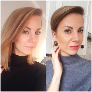 lip fillers